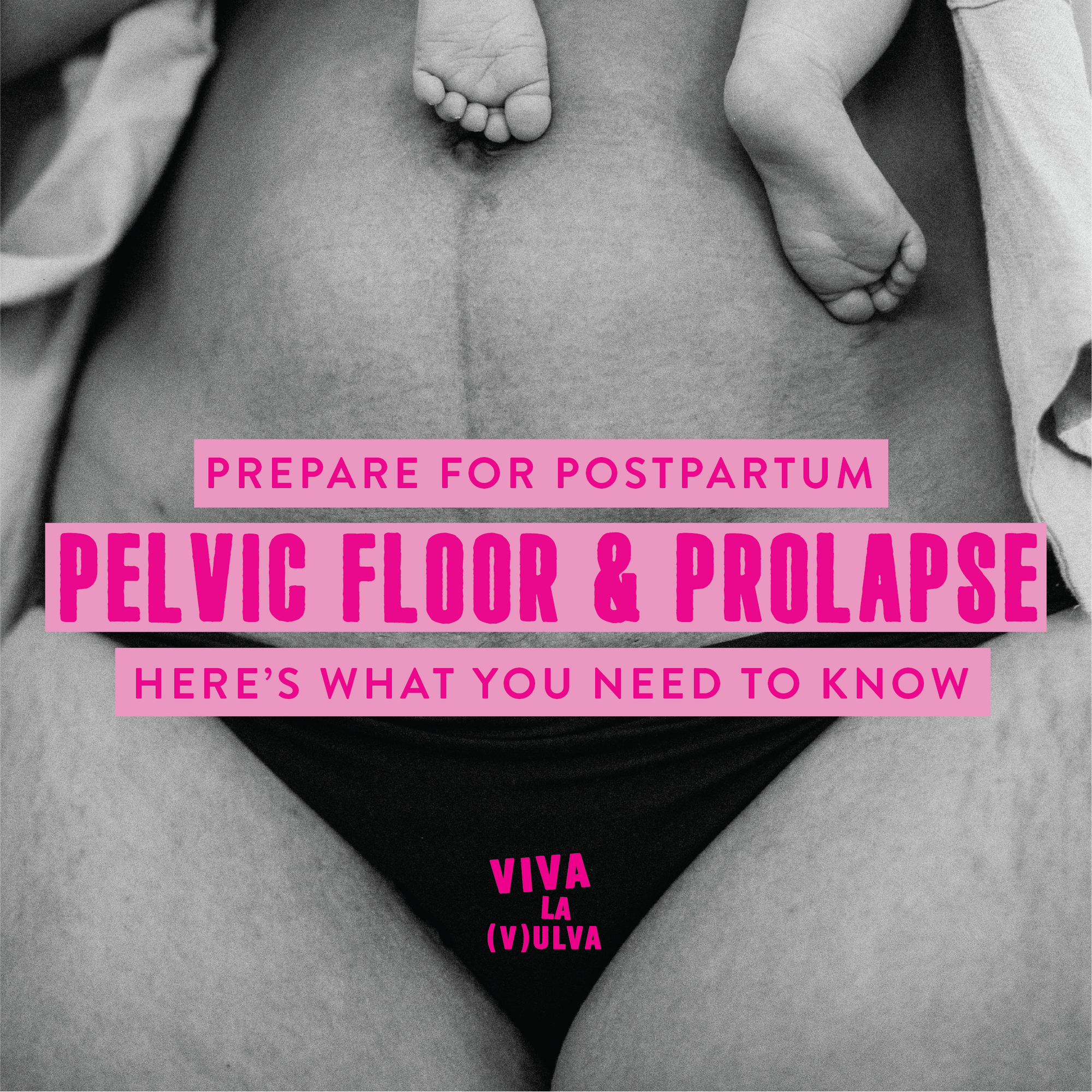 Pelvic Floor & Prolapse, Here's What You Need To Know